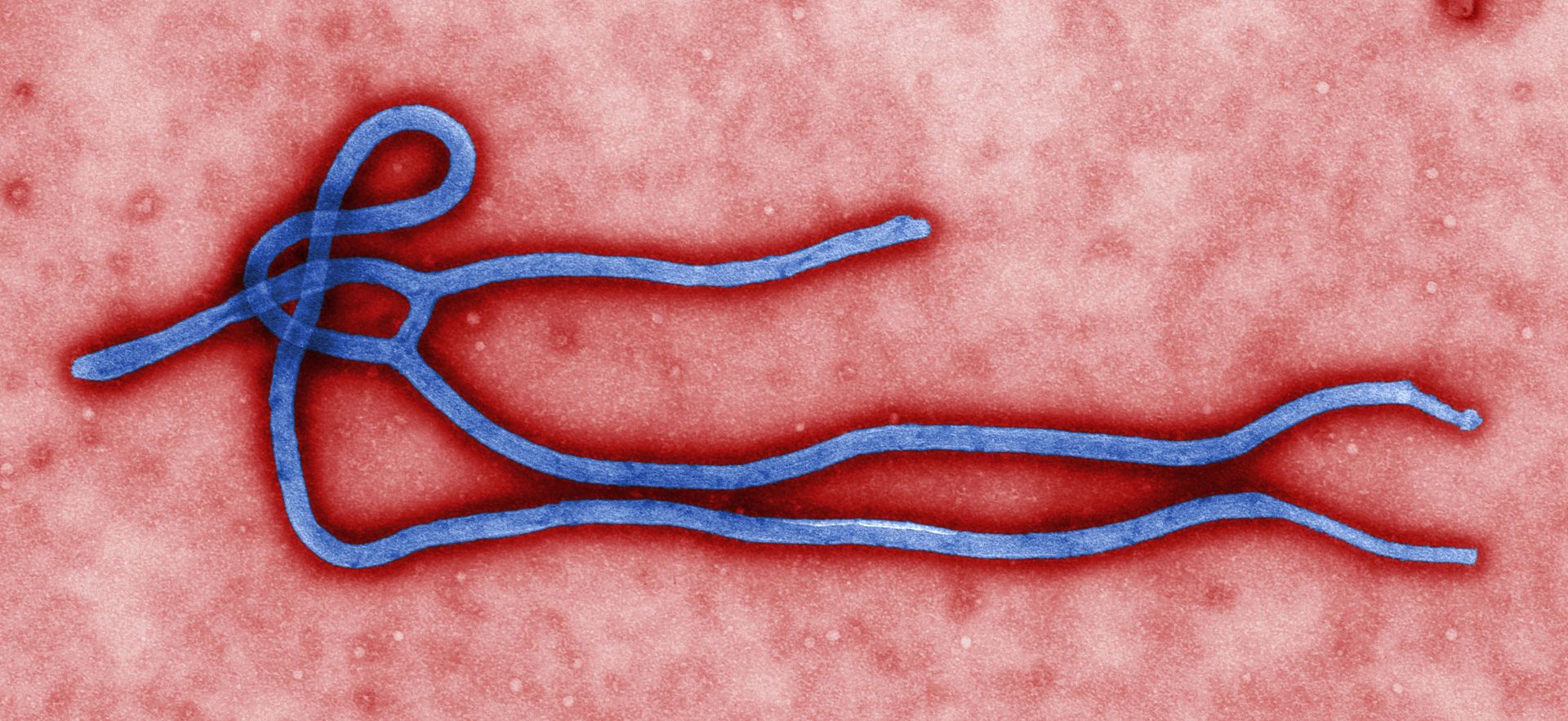 2014-09-17 Ebola_virus_virion
